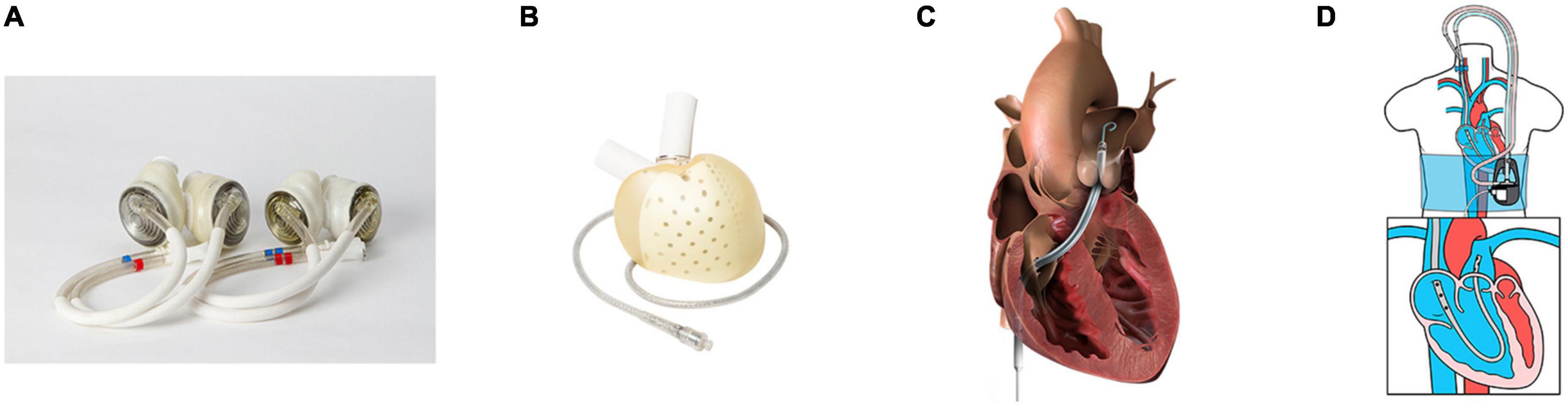 Biventricular assist devices and total artificial heart: Strategies and outcomes